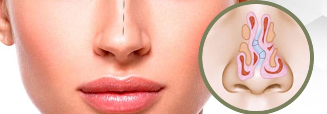 especialidade-septoplastia-site-rinite-alergica-otorrino