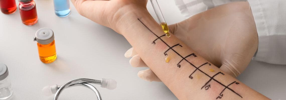 especialidade-teste-cutaneo-braço-rinite-alergica-otorrino-otorrinolaringologia